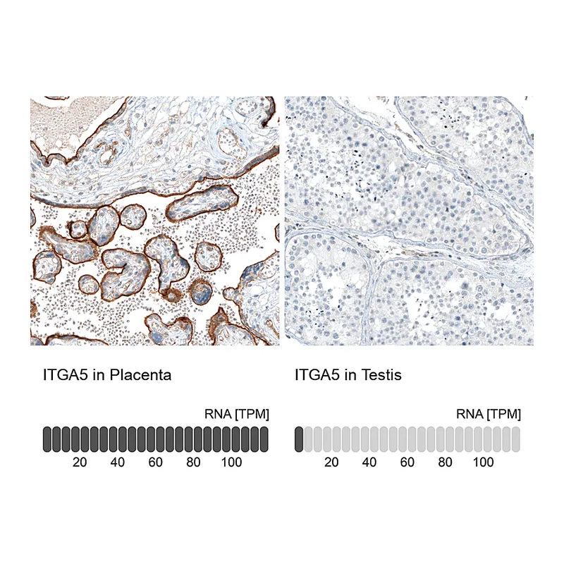Atlas Antibodies Anti-ITGA5 Antibody