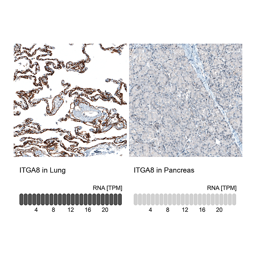 Atlas Antibodies Anti-ITGA8 Antibody