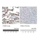 Atlas Antibodies Anti-ITGA8 Antibody