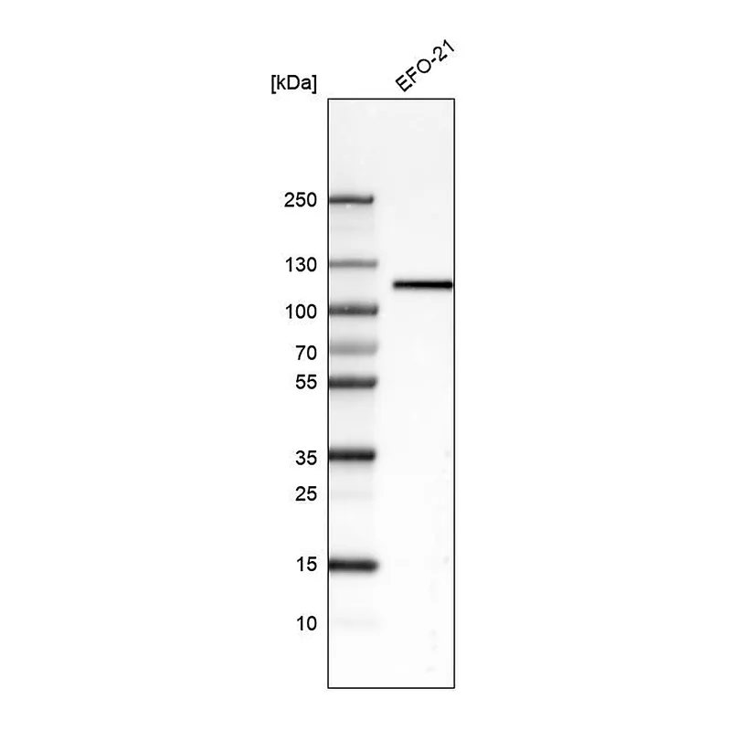 Atlas Antibodies Anti-ITGB3 Antibody