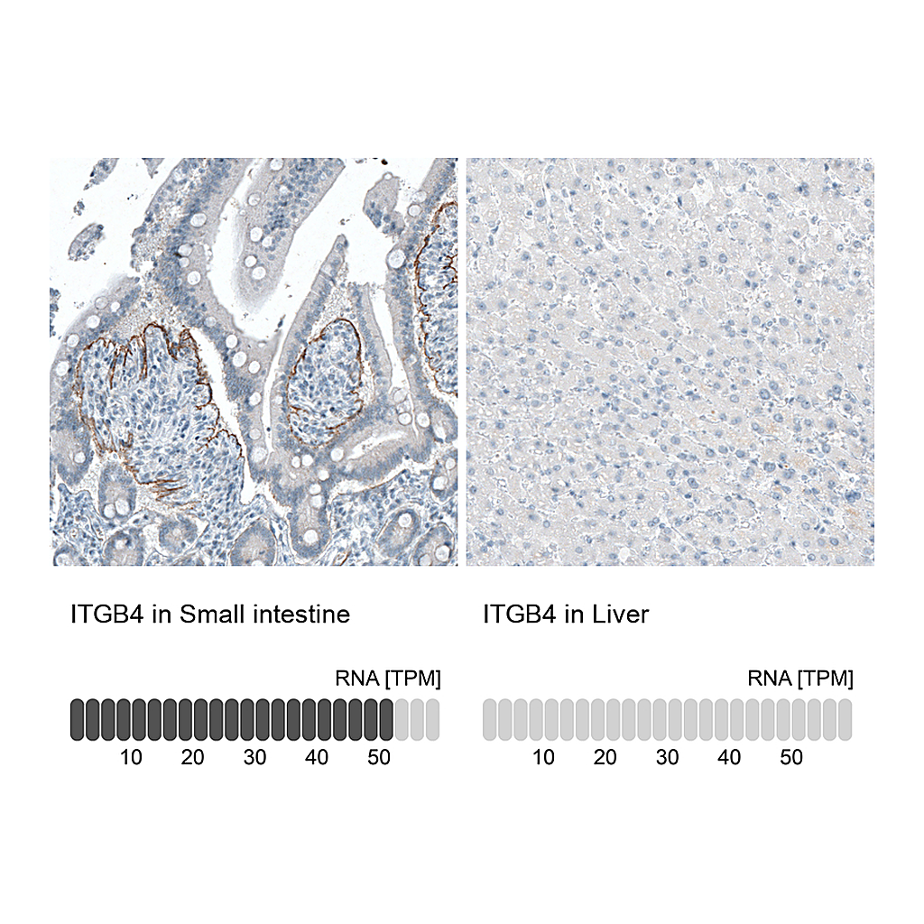 Atlas Antibodies Anti-ITGB4 Antibody