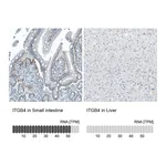 Atlas Antibodies Anti-ITGB4 Antibody