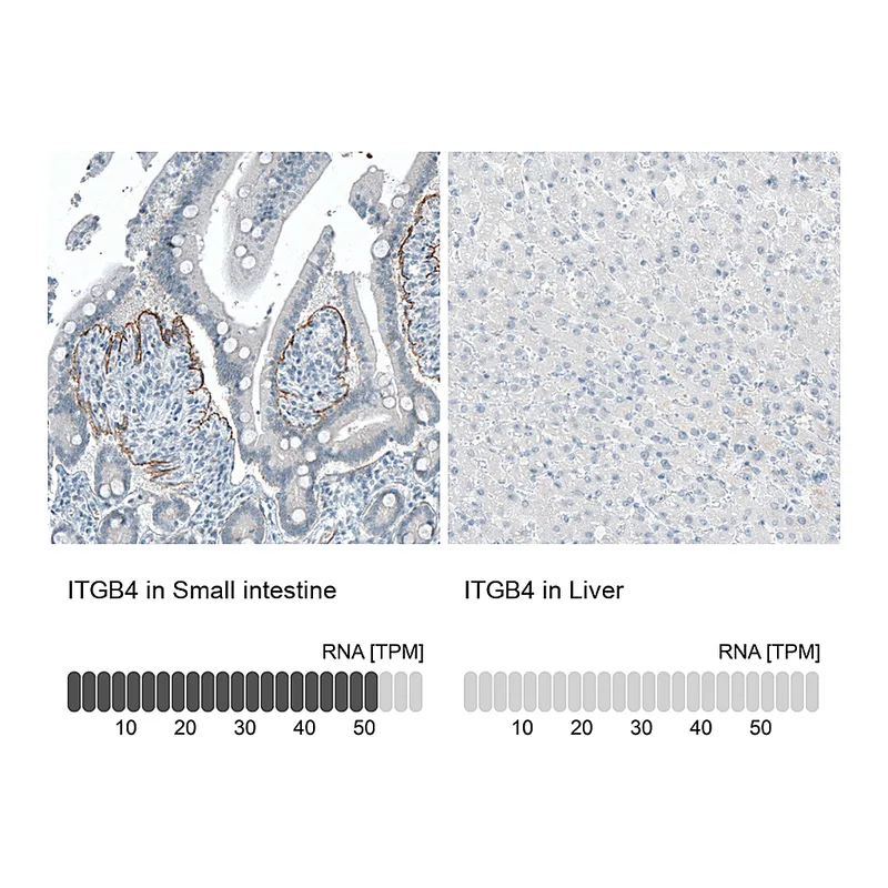 Atlas Antibodies Anti-ITGB4 Antibody