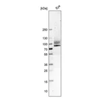 Atlas Antibodies Anti-ITGB8 Antibody