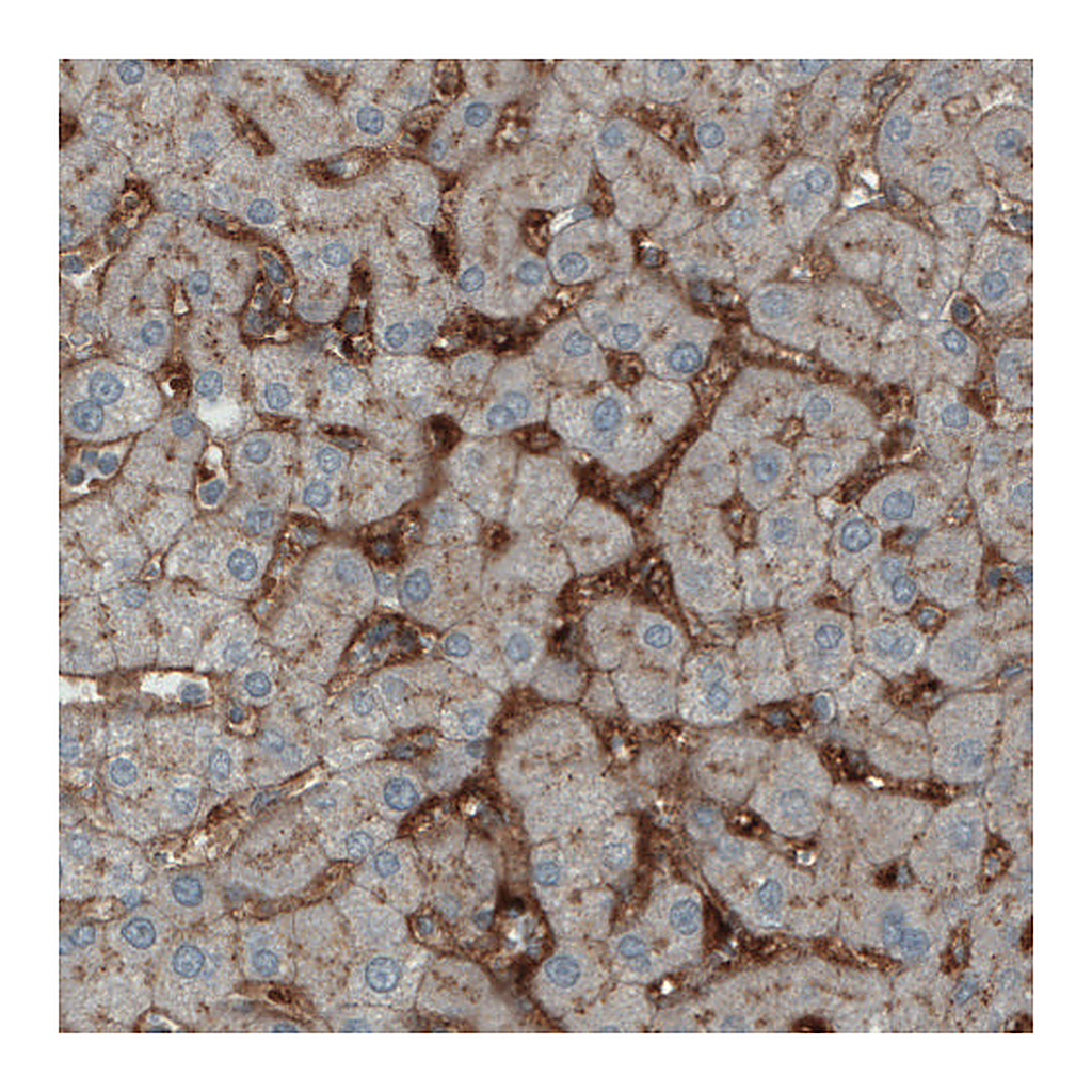 Atlas Antibodies Anti-ITIH4 Antibody