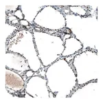 Atlas Antibodies Anti-JUN Antibody