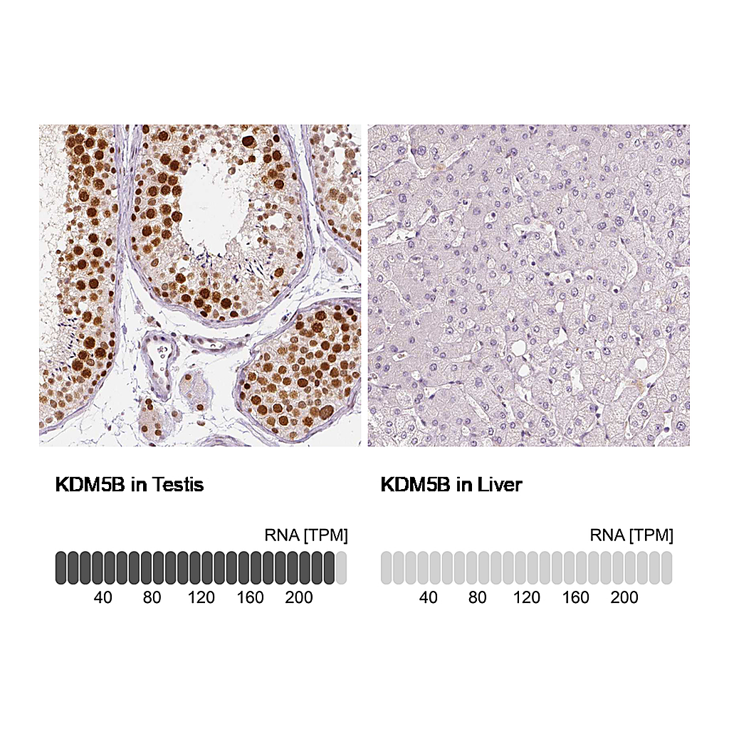 Atlas Antibodies Anti-KDM5B Antibody