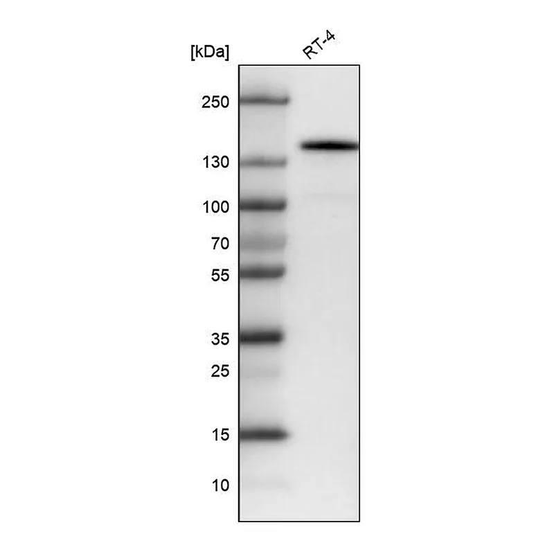 Atlas Antibodies Anti-KIT Antibody