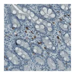 Atlas Antibodies Anti-KIT Antibody