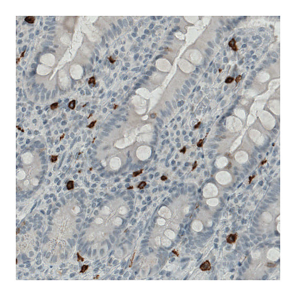 Atlas Antibodies Anti-KIT Antibody