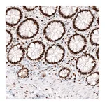 Atlas Antibodies Anti-KLF4 Antibody