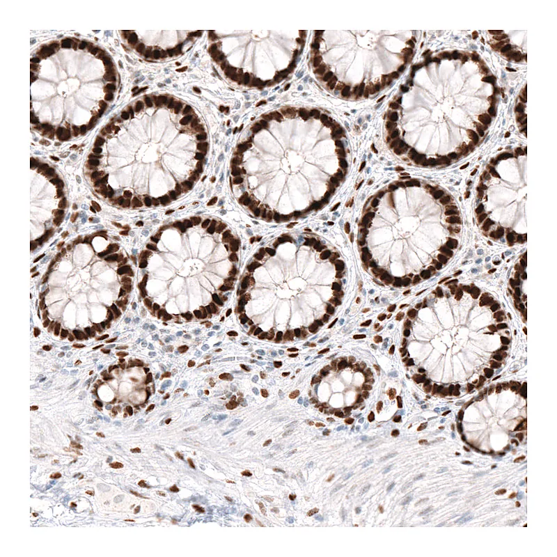 Atlas Antibodies Anti-KLF4 Antibody