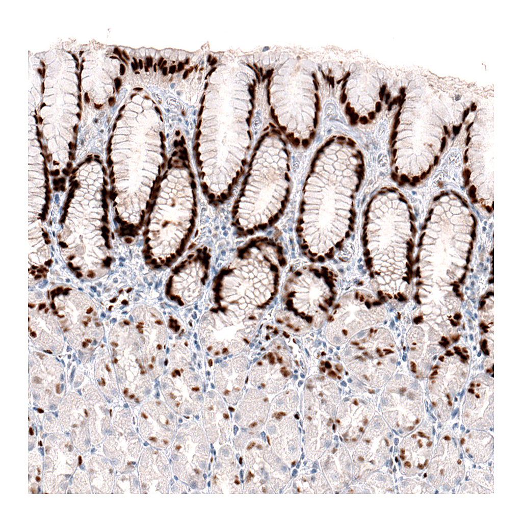 Atlas Antibodies Anti-KLF4 Antibody