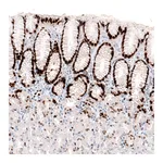 Atlas Antibodies Anti-KLF4 Antibody