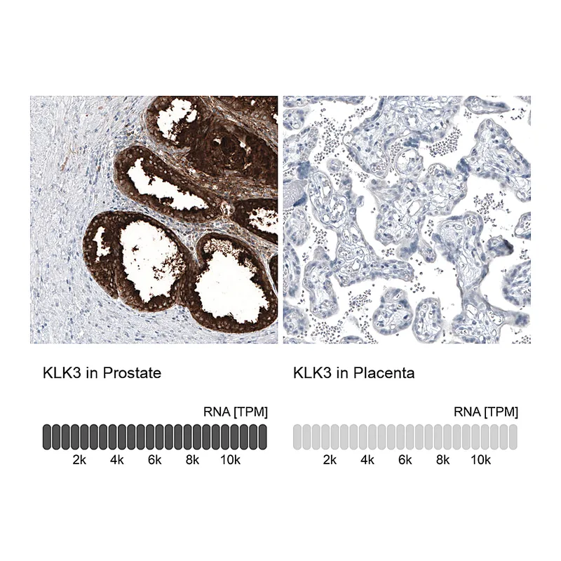 Atlas Antibodies Anti-KLK3 Antibody