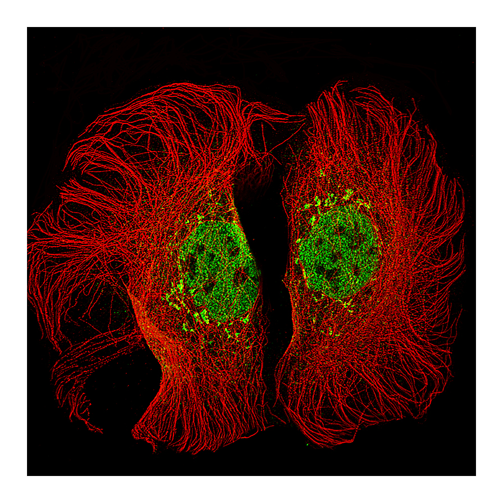Atlas Antibodies Anti-KMT2D Antibody