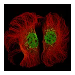 Atlas Antibodies Anti-KMT2D Antibody