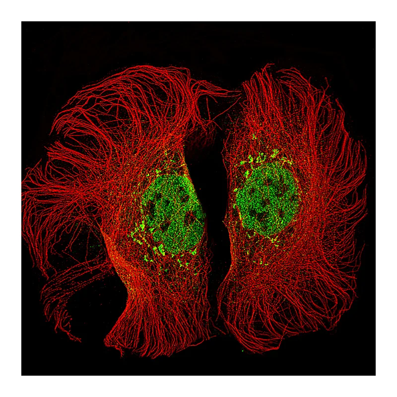 Atlas Antibodies Anti-KMT2D Antibody