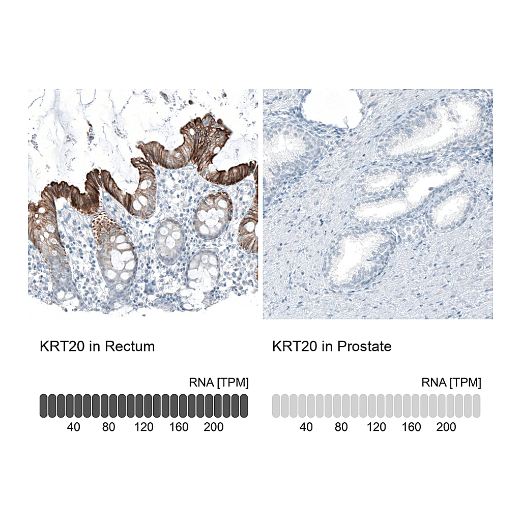 Atlas Antibodies Anti-KRT20 Antibody