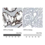 Atlas Antibodies Anti-KRT5 Antibody