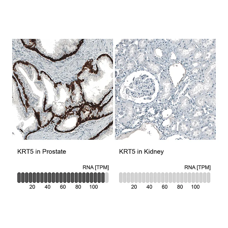 Atlas Antibodies Anti-KRT5 Antibody