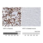 Atlas Antibodies Anti-KRT7 Antibody