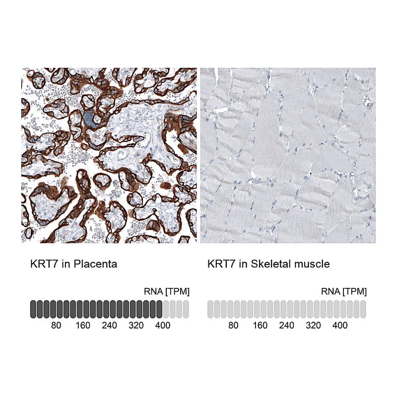Atlas Antibodies Anti-KRT7 Antibody