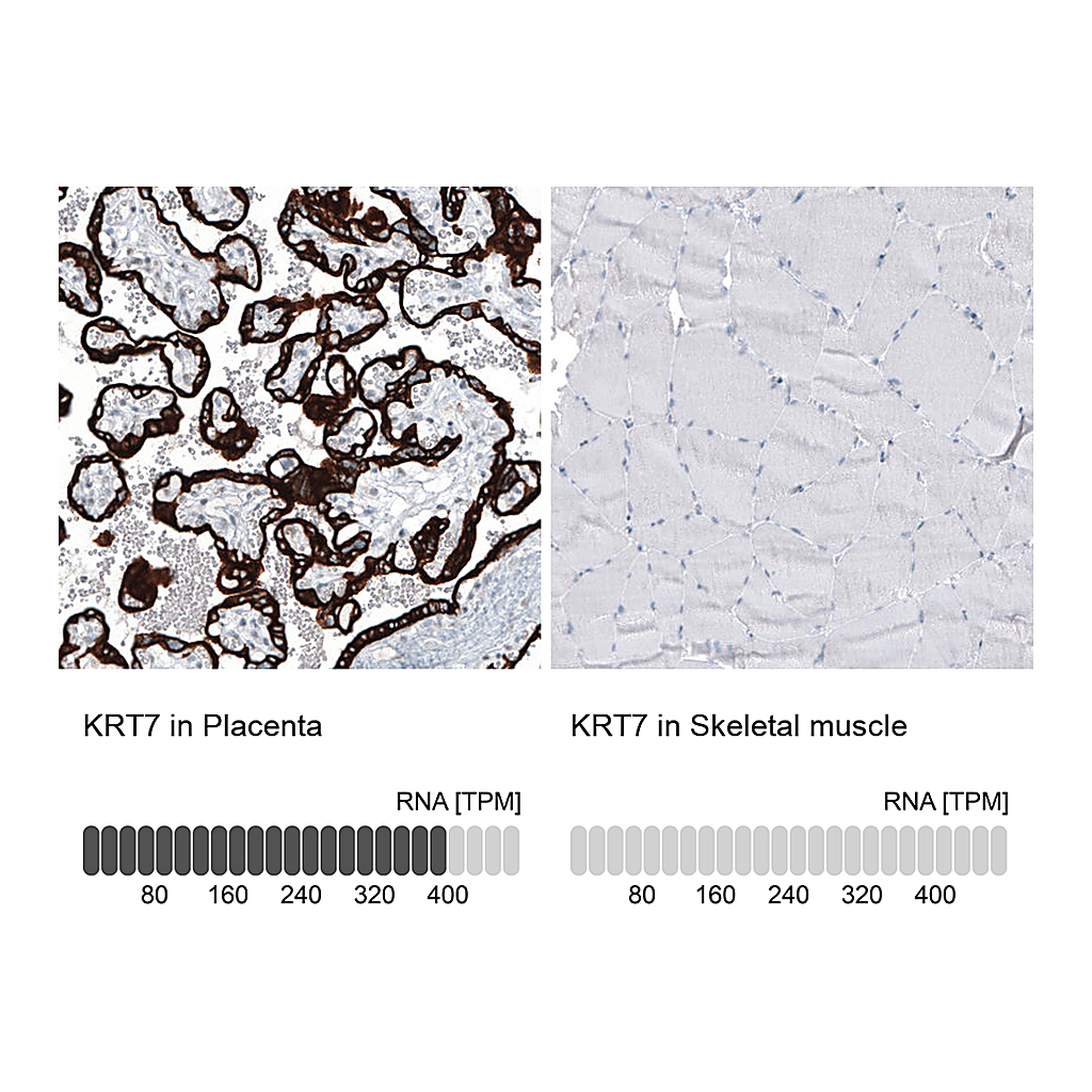 Atlas Antibodies Anti-KRT7 Antibody