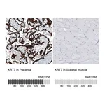 Atlas Antibodies Anti-KRT7 Antibody