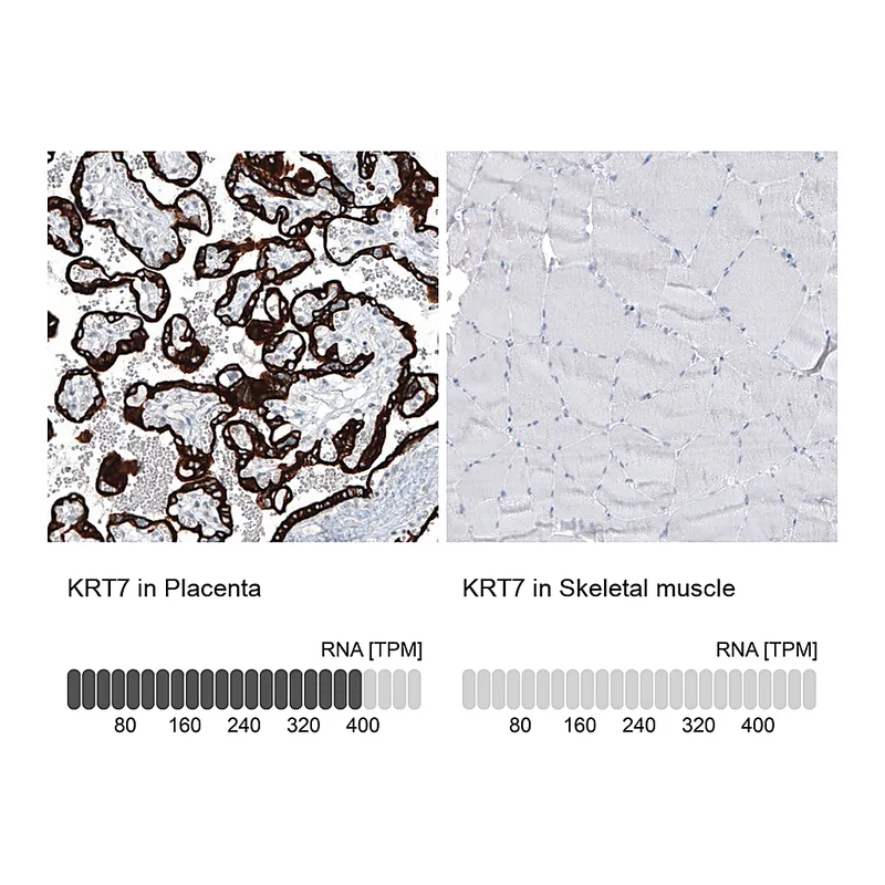 Atlas Antibodies Anti-KRT7 Antibody