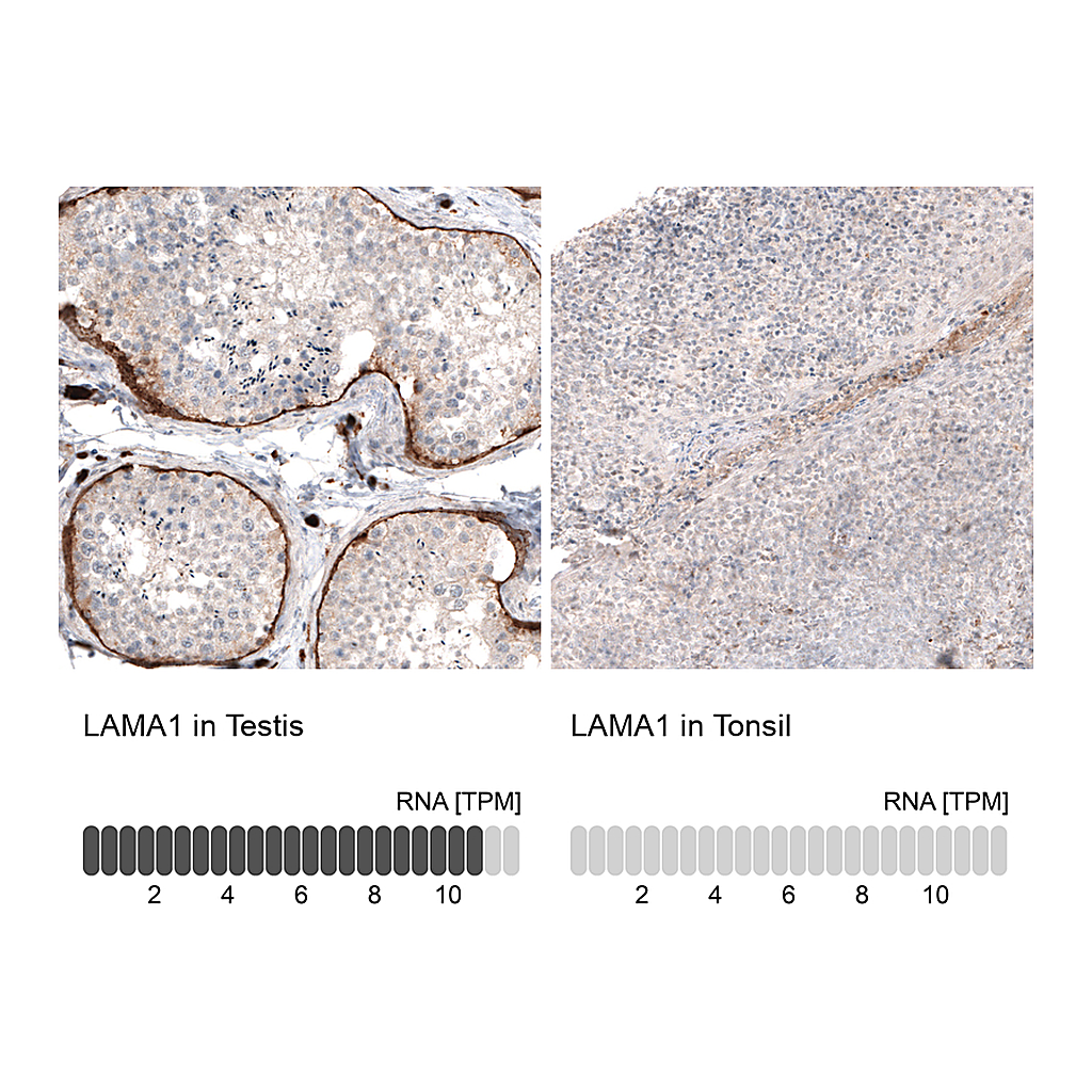Atlas Antibodies Anti-LAMA1 Antibody