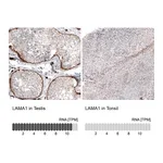 Atlas Antibodies Anti-LAMA1 Antibody