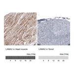 Atlas Antibodies Anti-LAMA2 Antibody