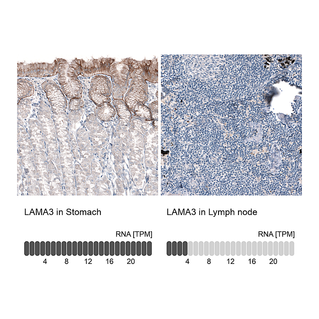 Atlas Antibodies Anti-LAMA3 Antibody