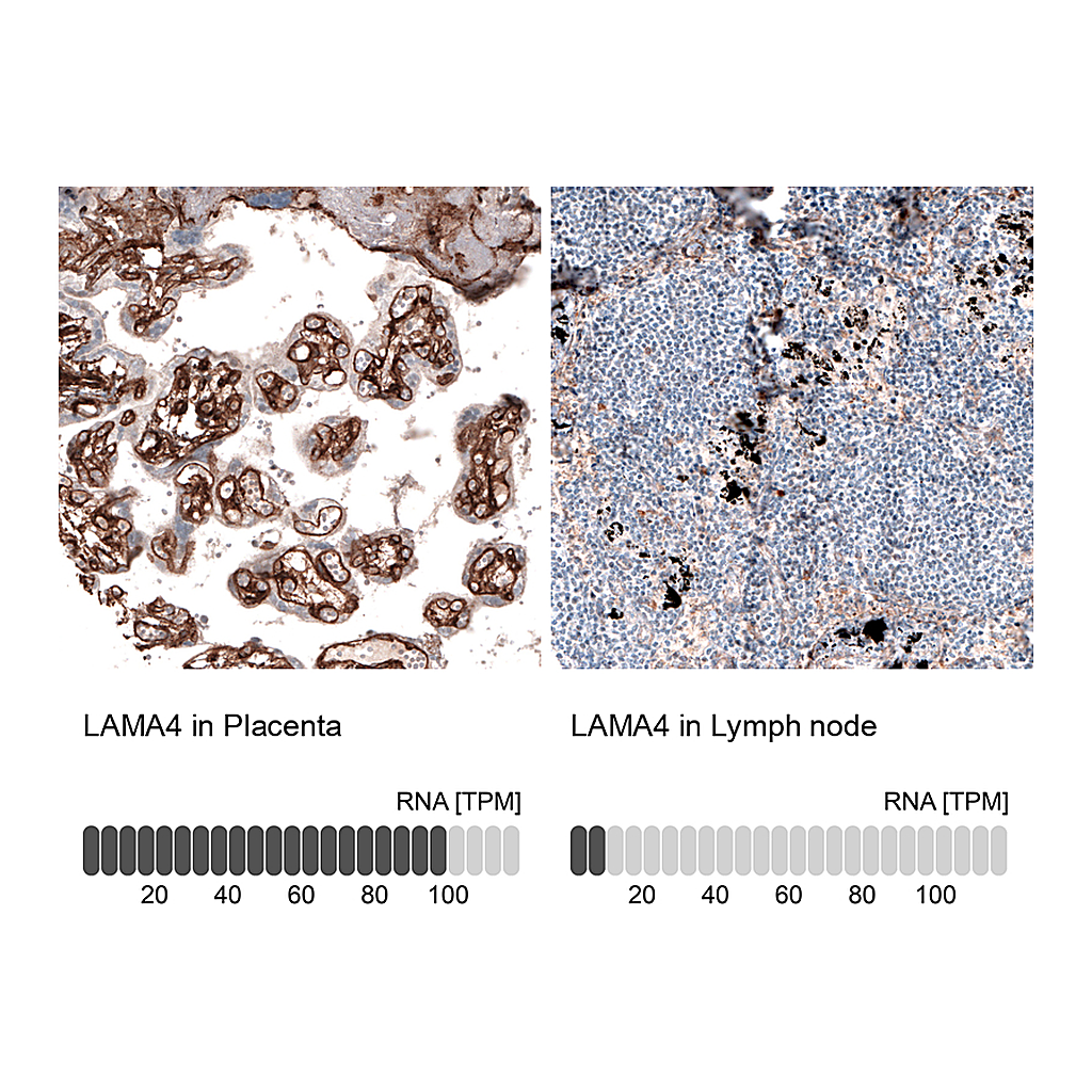 Atlas Antibodies Anti-LAMA4 Antibody