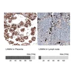 Atlas Antibodies Anti-LAMA4 Antibody