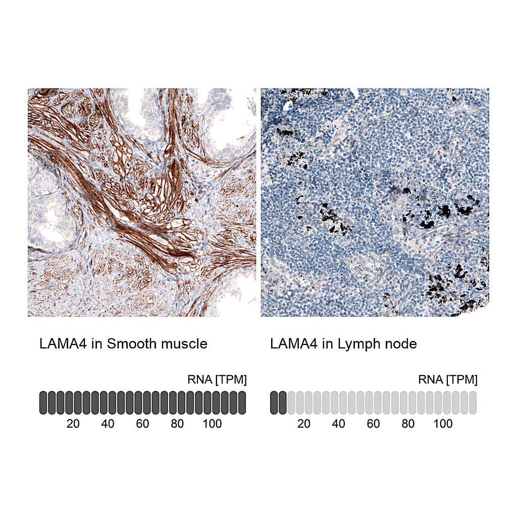Atlas Antibodies Anti-LAMA4 Antibody