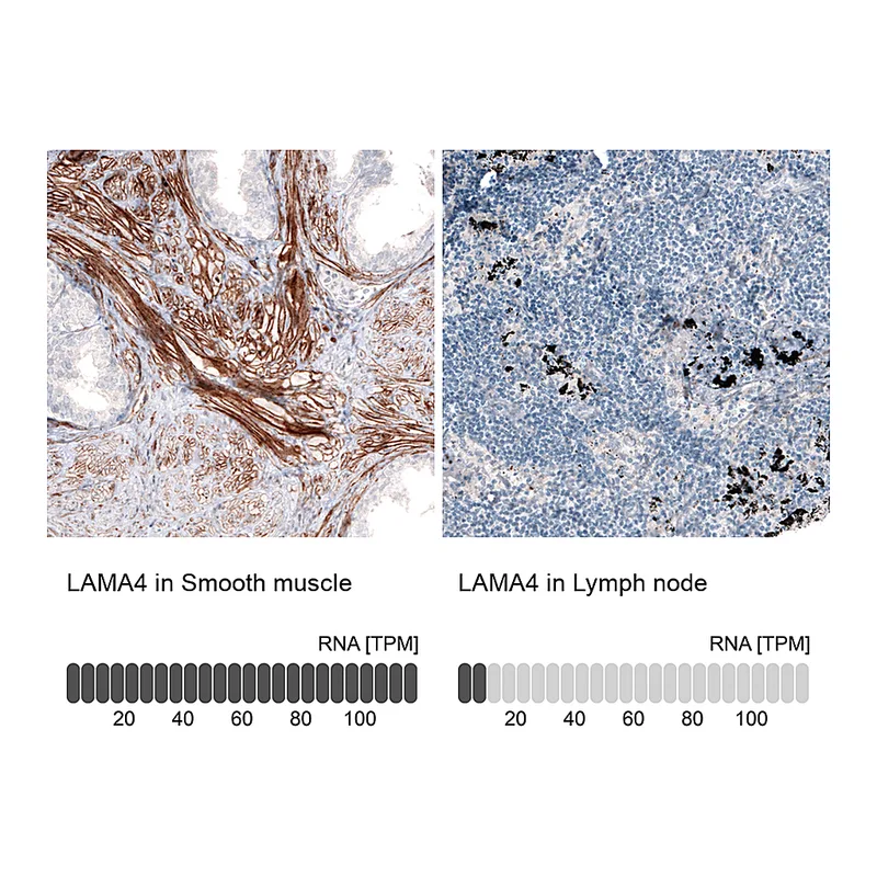 Atlas Antibodies Anti-LAMA4 Antibody