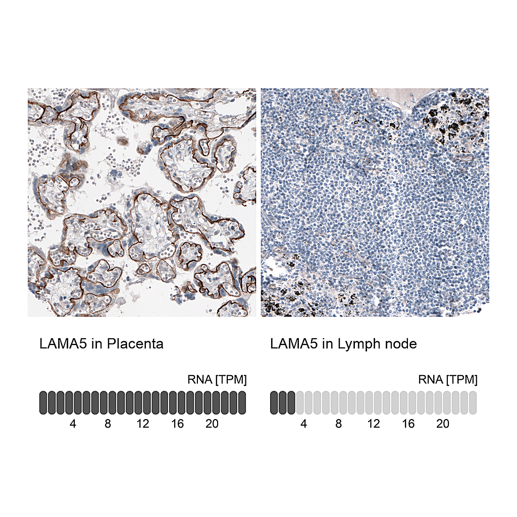 Atlas Antibodies Anti-LAMA5 Antibody