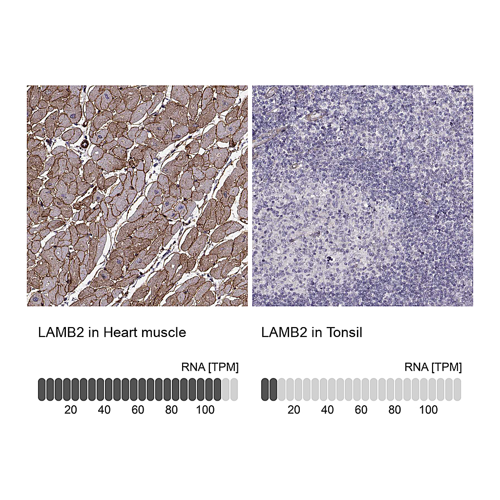 Atlas Antibodies Anti-LAMB2 Antibody