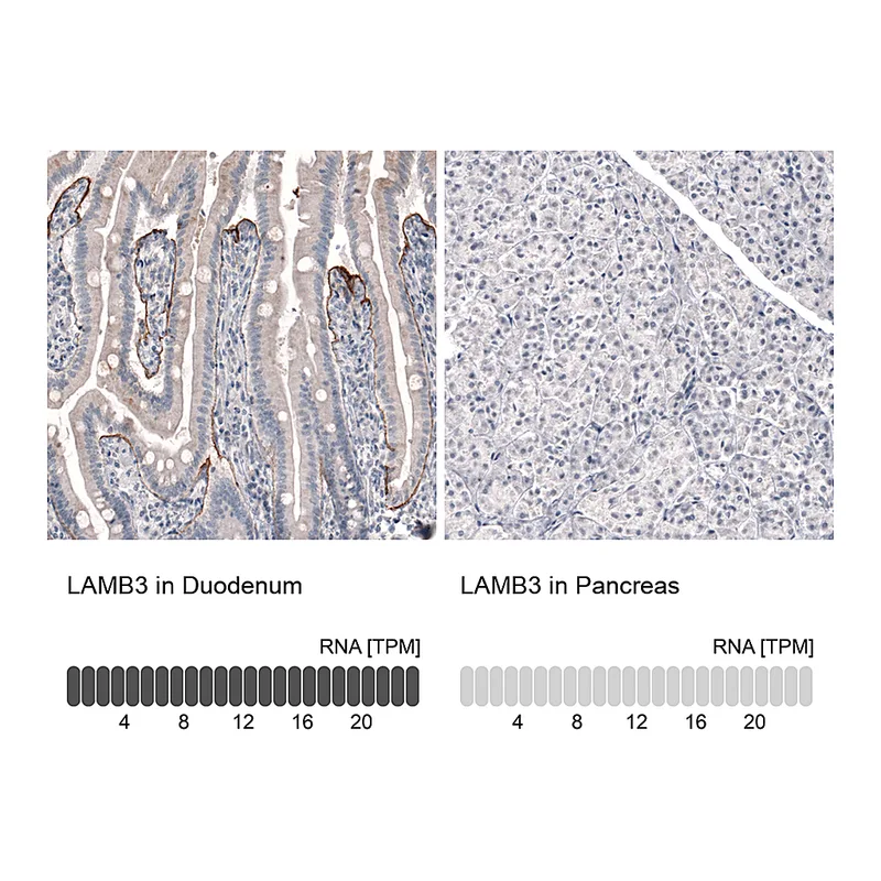 Atlas Antibodies Anti-LAMB3 Antibody
