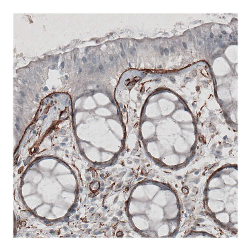 Atlas Antibodies Anti-LAMC1 Antibody