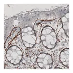 Atlas Antibodies Anti-LAMC1 Antibody