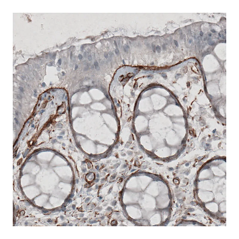 Atlas Antibodies Anti-LAMC1 Antibody