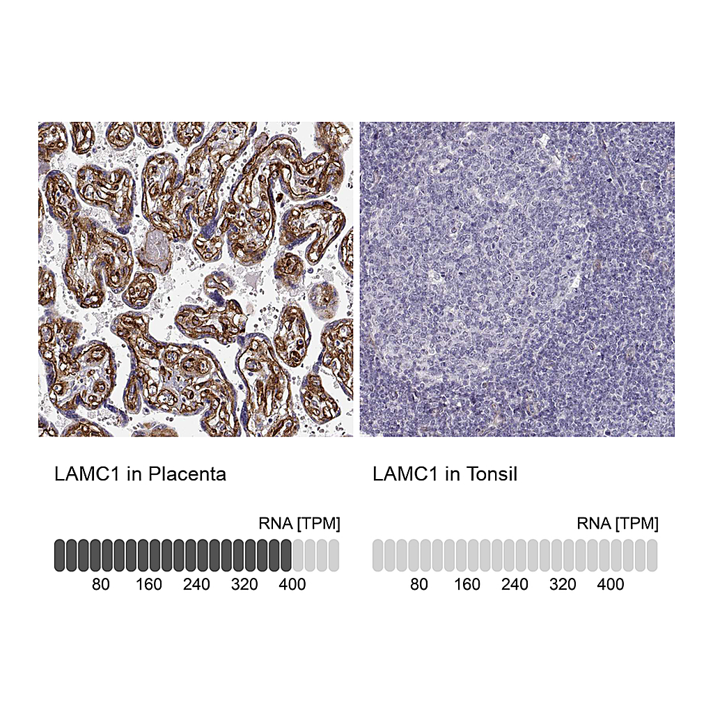 Atlas Antibodies Anti-LAMC1 Antibody