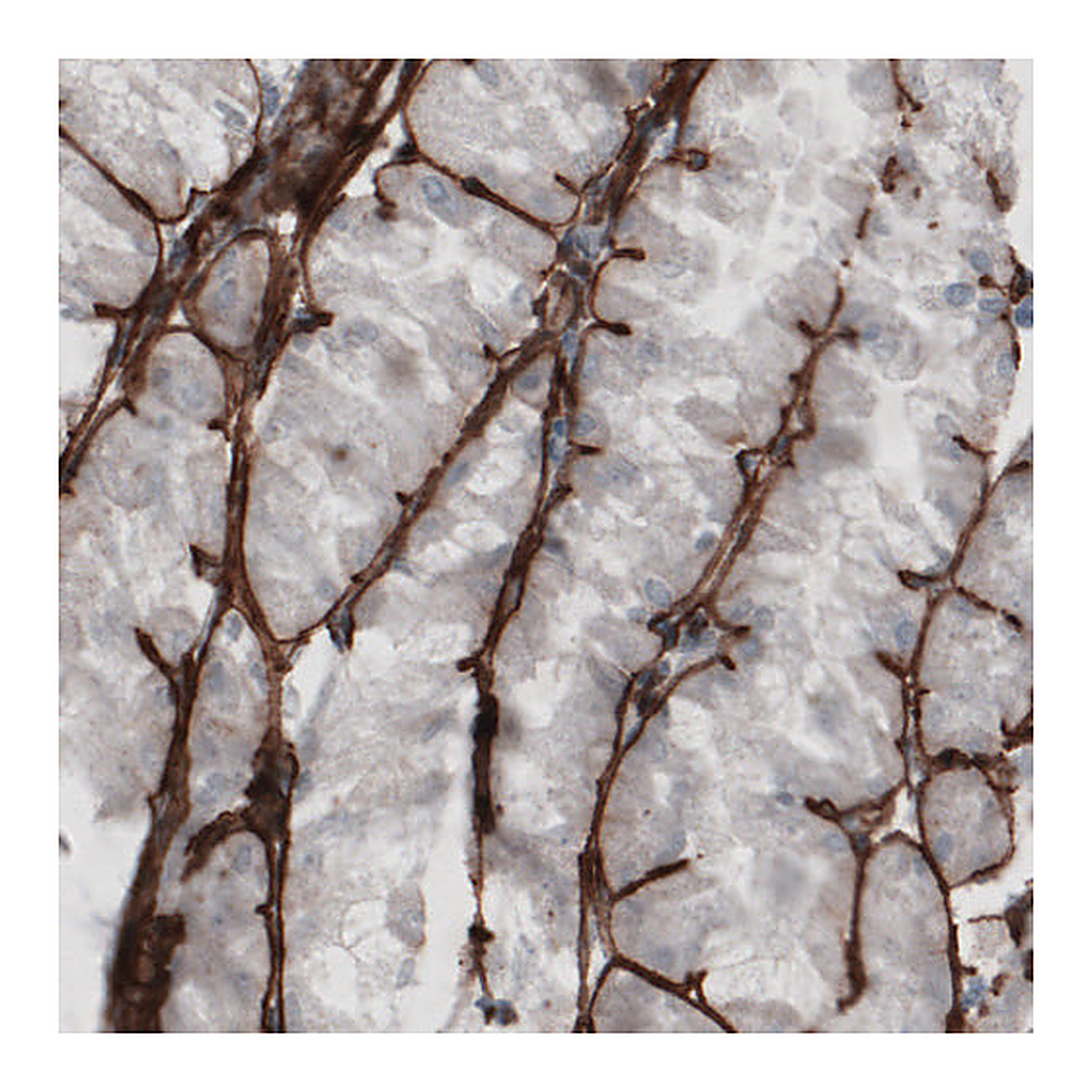 Atlas Antibodies Anti-LAMC1 Antibody
