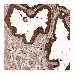 Atlas Antibodies Anti-LAMP1 Antibody