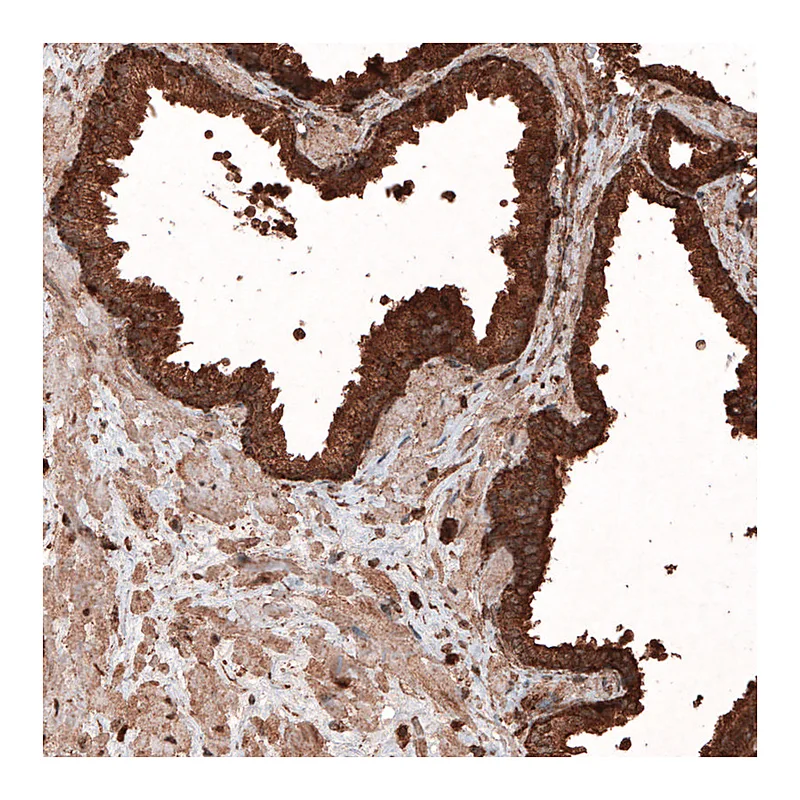 Atlas Antibodies Anti-LAMP1 Antibody