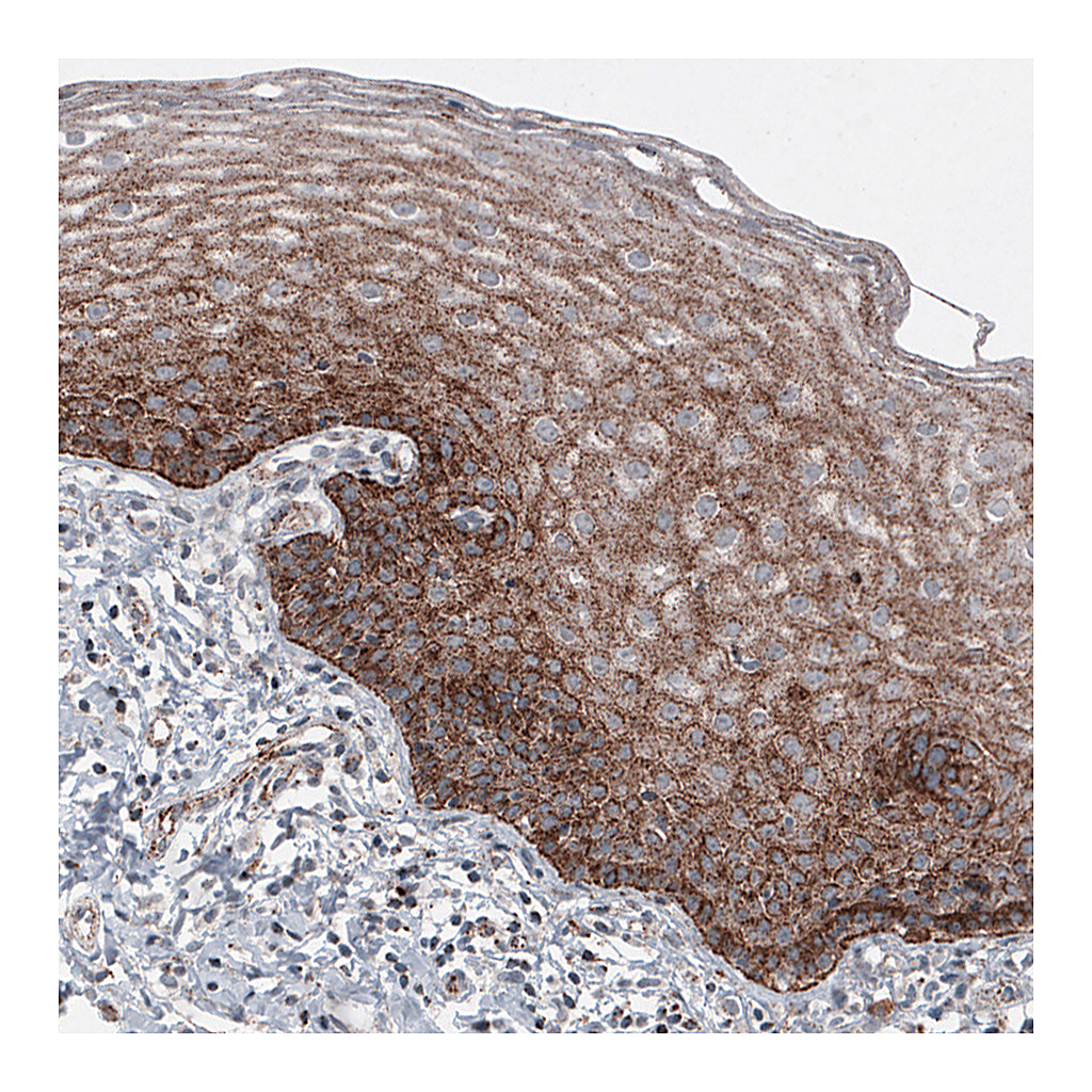 Atlas Antibodies Anti-LAMP1 Antibody