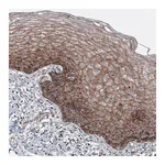 Atlas Antibodies Anti-LAMP1 Antibody